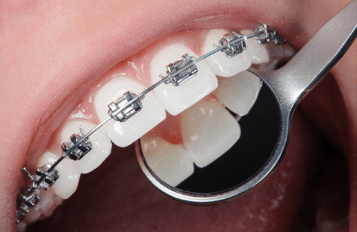 orthodontist in Blue Springs