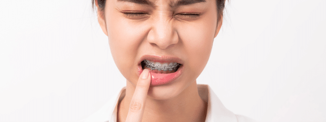 Orthodontist in Blue Springs