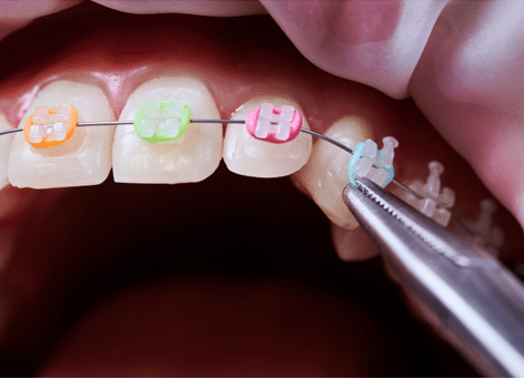 orthodontist in Blue Springs
