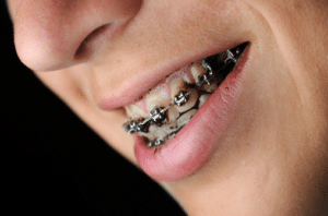 Orthodontist in Blue Springs