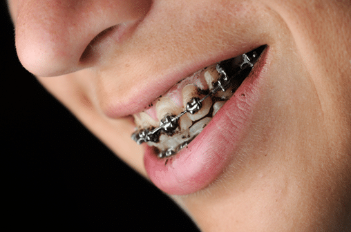 Orthodontist in Blue Springs