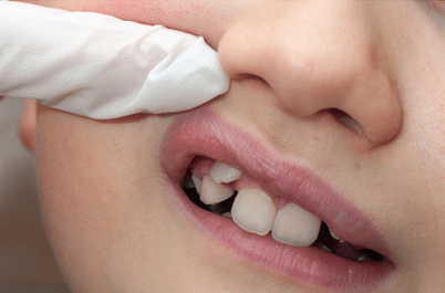 Pediatric Orthodontist in Independence