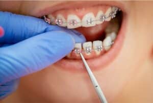 Orthodontist in Independence