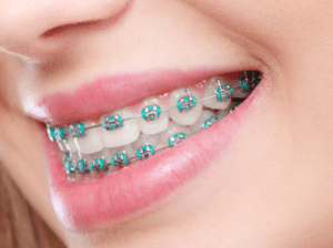 Orthodontist in Mission