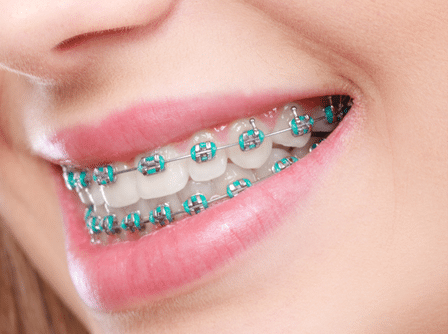 Orthodontist in Blue Springs